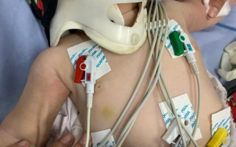 Pai de bebê internada em UTI com mais de 30 lesões é preso em Anápolis